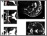 [thumbnail of Figure 1]