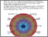 [thumbnail of ANCIL_in_action_progress_updates_on_A_Ne.pdf]
